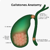 পিত্তথলির পাথর (Gall bladder stone)