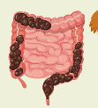 কোষ্ঠকাঠিন্য- constipation
