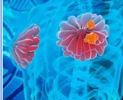বাম স্তন ও ডান ডিম্বাশয়ের টিউমার- Left breast tumor and right ovary rumor