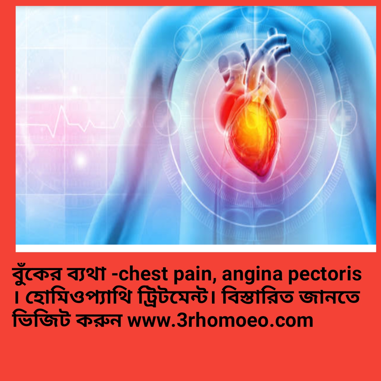 বুকে ব্যথা, হৃদপিণ্ডে ব্যথা-ANGINA PECTORIS