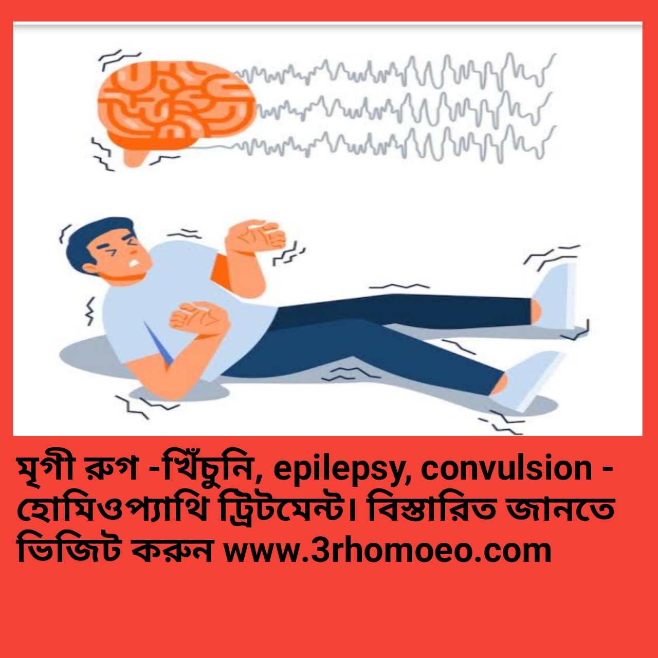 মৃগী রোগ (Epilepsy)