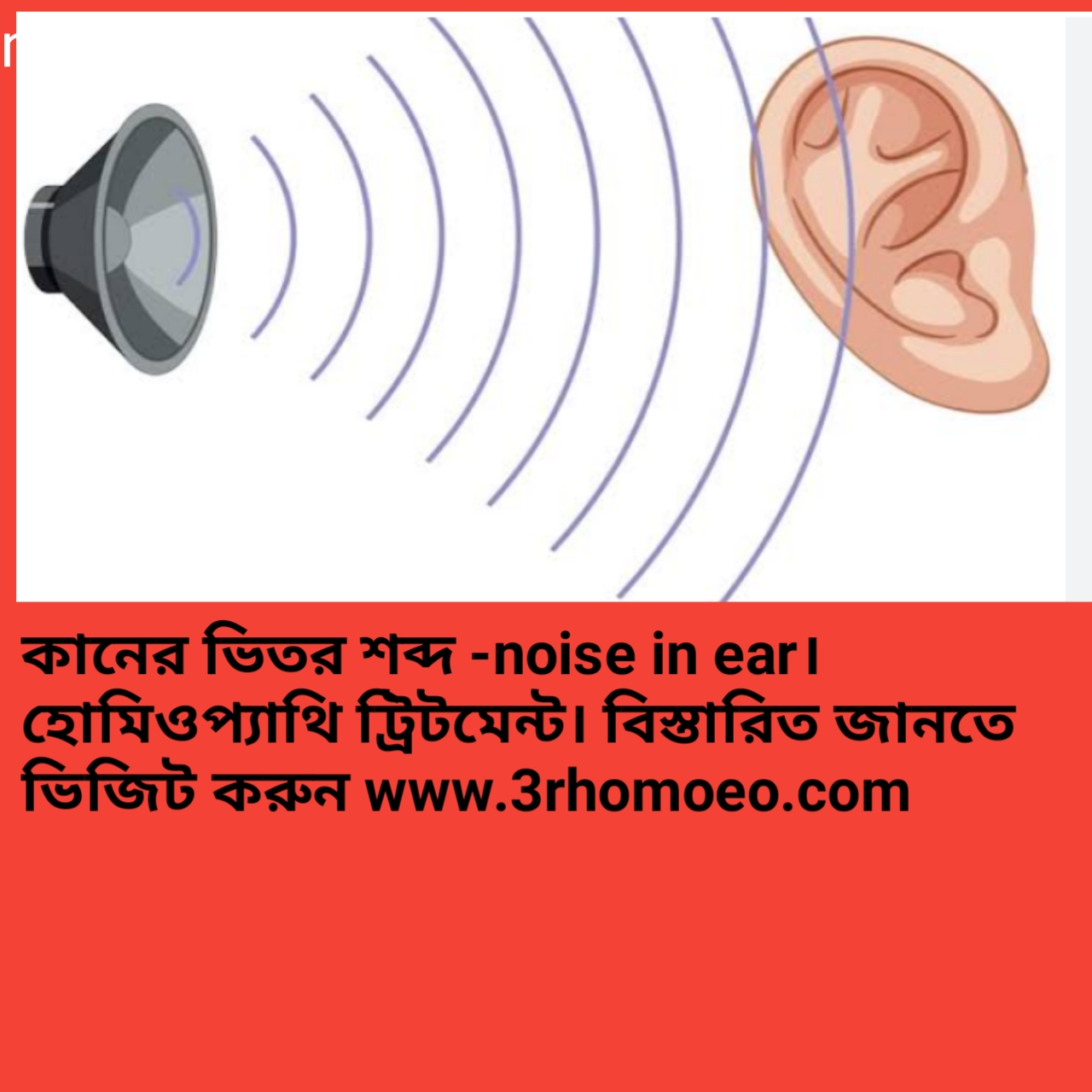 কানে ভোঁ ভোঁ বা শোঁ শোঁ শব্দ হওয়া"-Tinnitus