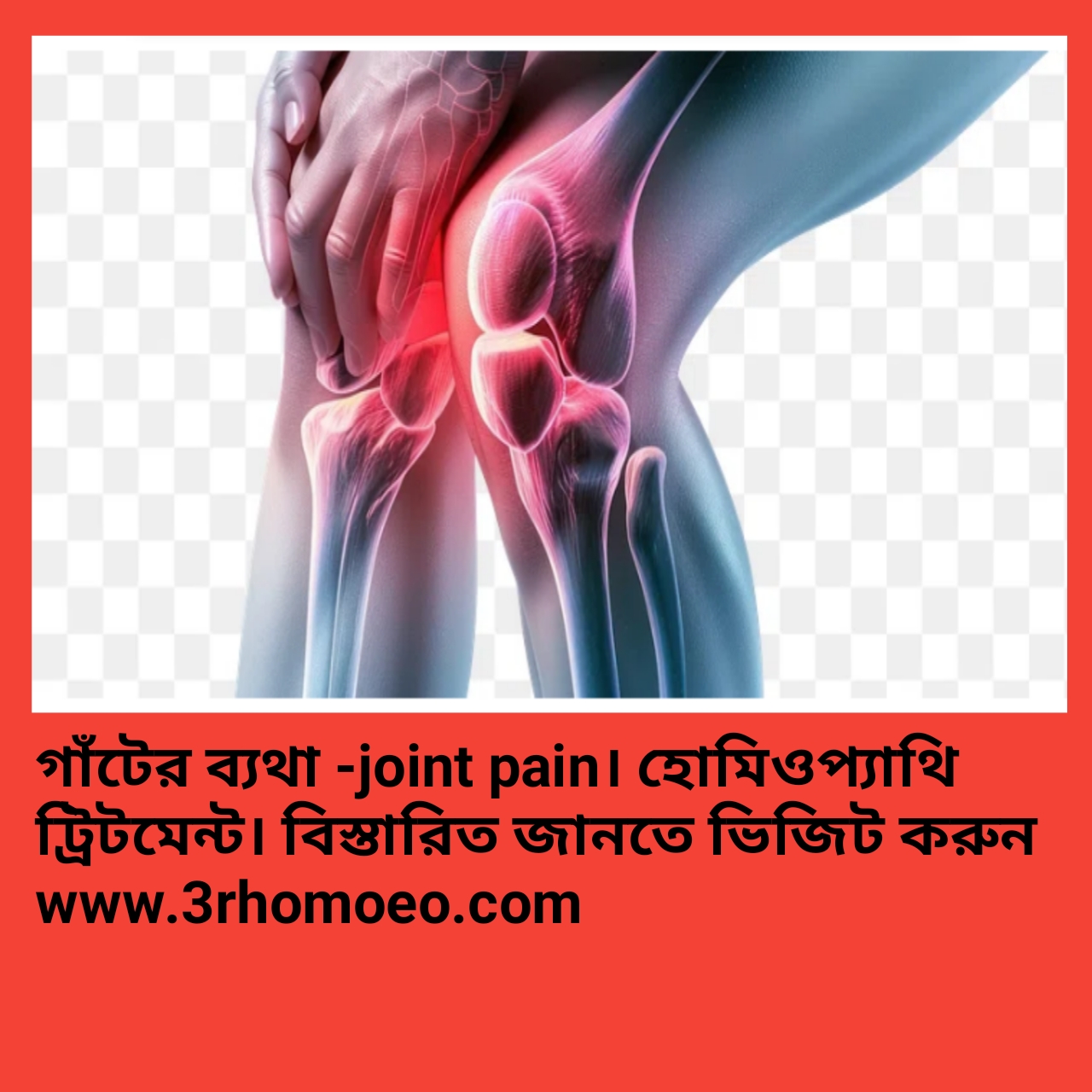 গাঁট বা জোড়ায় ব্যথা,-joint pain