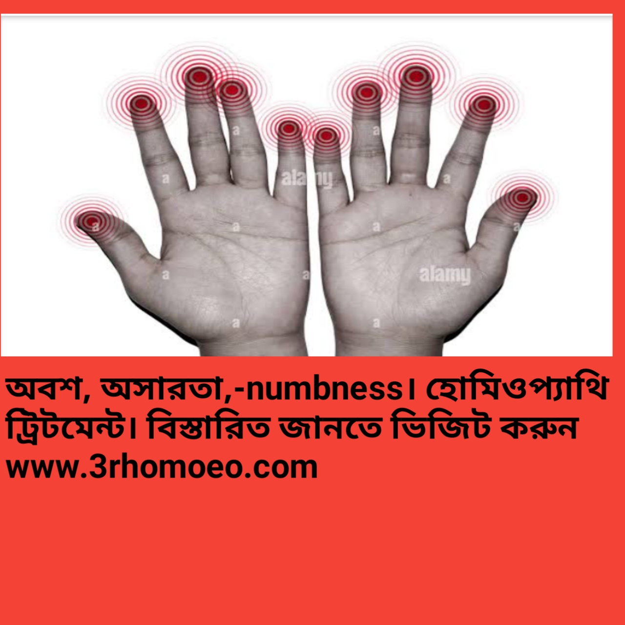 অবশ,অসারতা (Numbness)