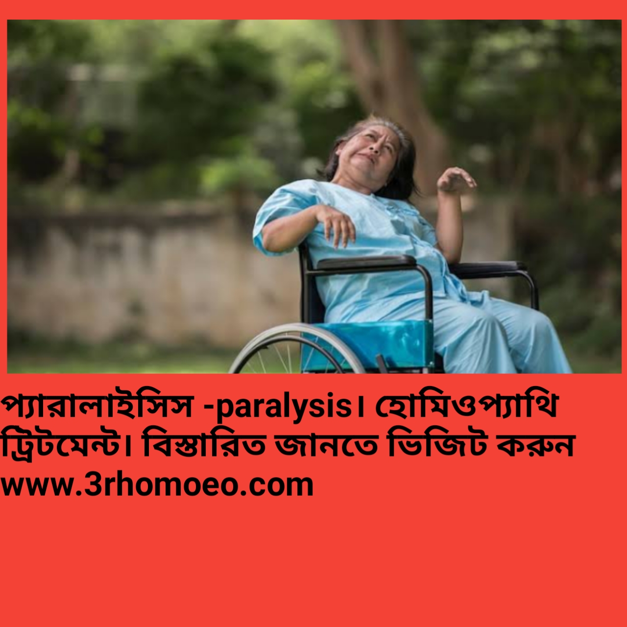 পক্ষাঘাত- paralysis