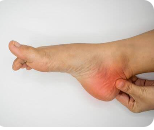 গোড়ালির ব্যথা- heel pain