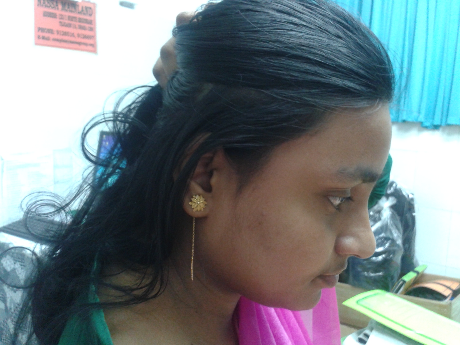 baldness after